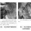 鸡胸前气囊和胸后气囊解剖学观察
